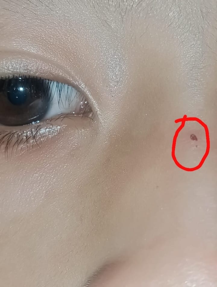 Diduga Siswi Kelas IV di SDN Benteng Takalar Jadi Korban Kekerasan Fisik, Orang Tua Tuntut Tindakan Tegas